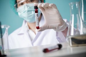 doctor-holding-testing-patients-blood-samples-coronavirus-outbreak-covid-19-laboratory-new-coronavirus-2019-ncov_185216-40